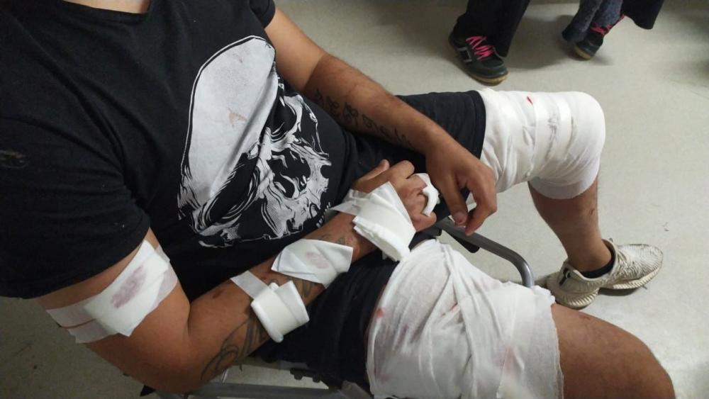 Tres personas heridas tras un cruce de facciones de la UOCRA en Ensenada